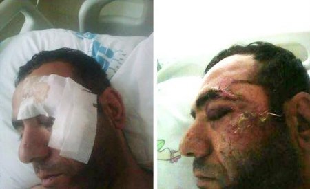 Ölümcül döyülən adam hospitala "xəstə" adı ilə yerləşdirildi - "Baku City Hospital"da DƏHŞƏTLİ FAKTLAR