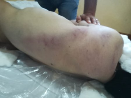 Vətəndaş iddia edir - Tural İsmayılov Siyəzən rayon polis idarəsində döyülərək öldürülüb - Video+Foto fakt